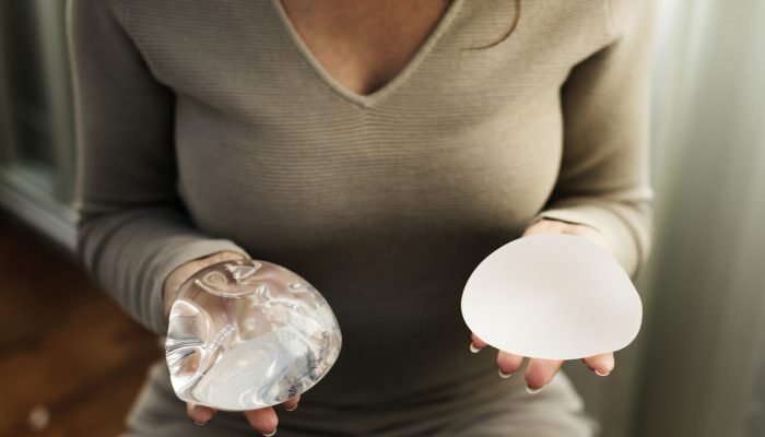10-Contratura-capsular-o-que-e-e-como-evitar